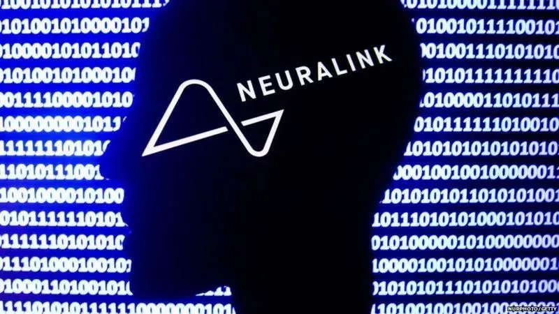 Brain Chip Brain Chip